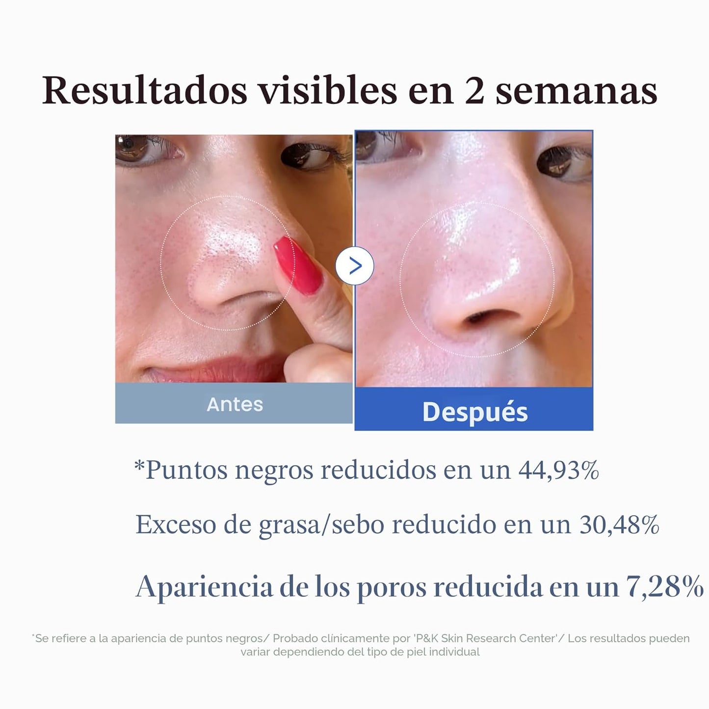 Medicube Zero Pore Pad 2.0 – Almohadillas Exfoliantes para Poros